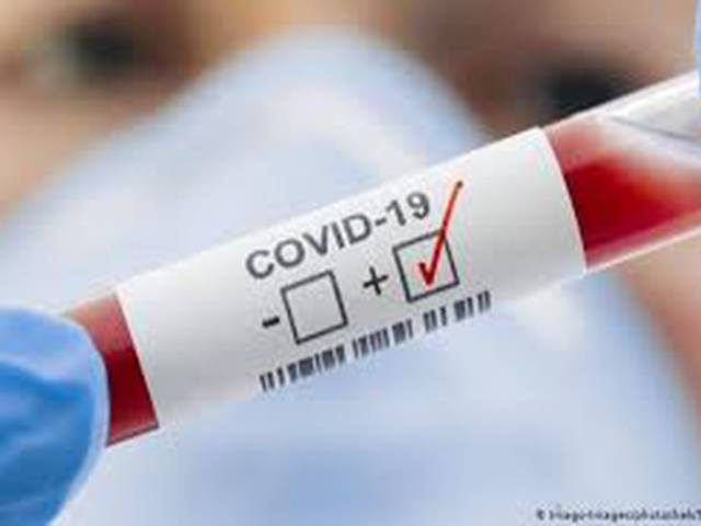 Turkey's Coronavirus Situation in 2020